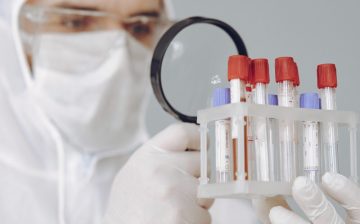 Public Health and Epidemiology